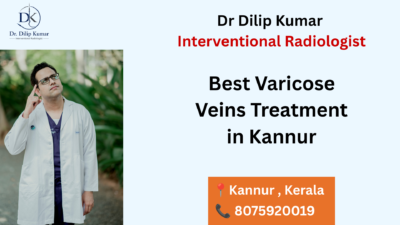 Best Varicose Veins Treatment in Kannur
