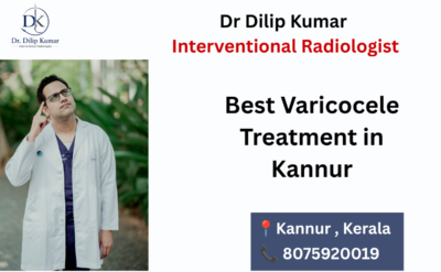 Best Varicocele Treatment in Kannur