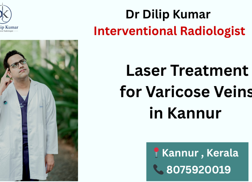 Laser Treatment for Varicose Veins