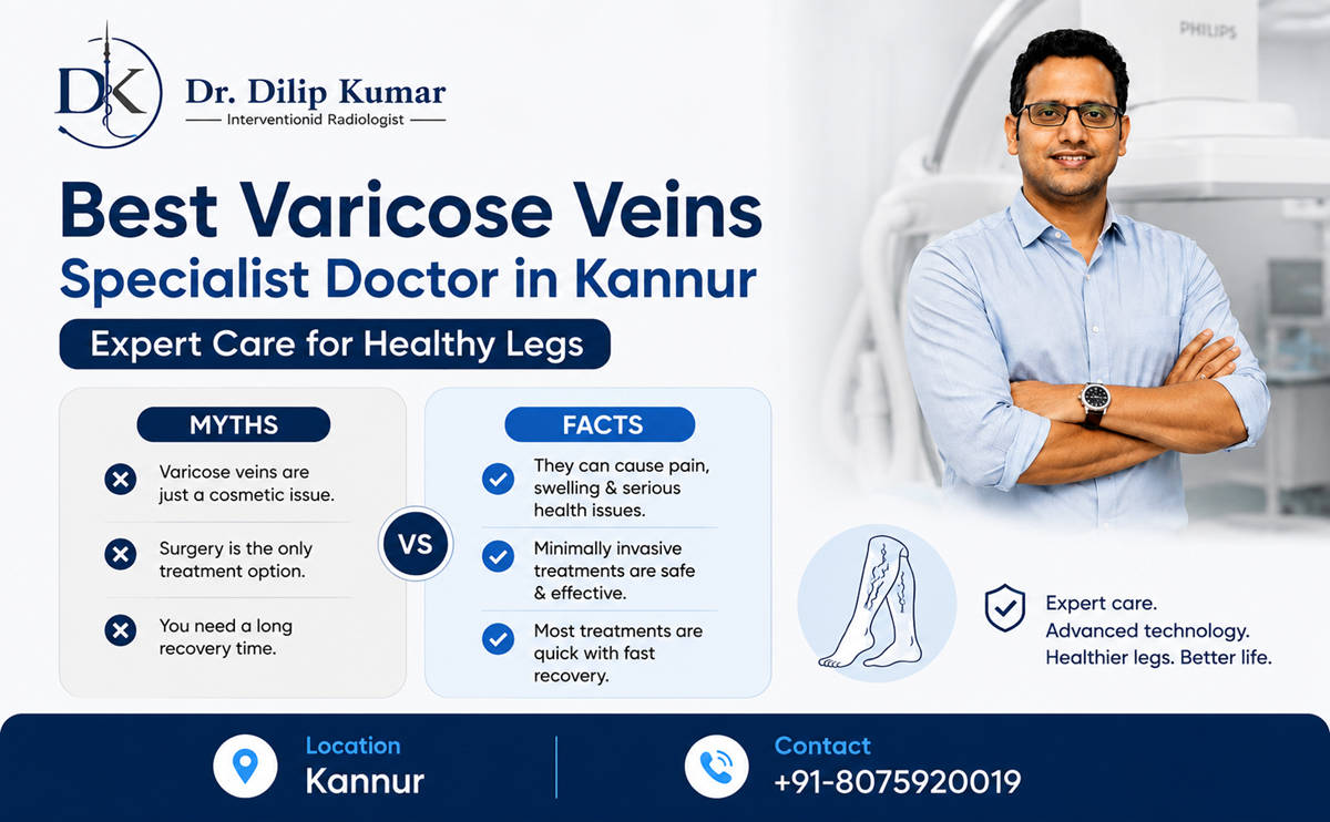 Best Varicose Veins Specialist Doctor in Kannur