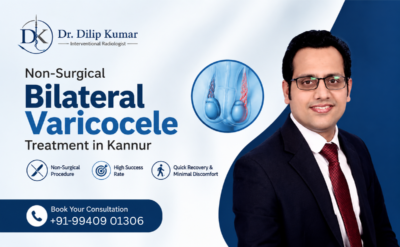 Bilateral Varicocele Treatment in Kannur