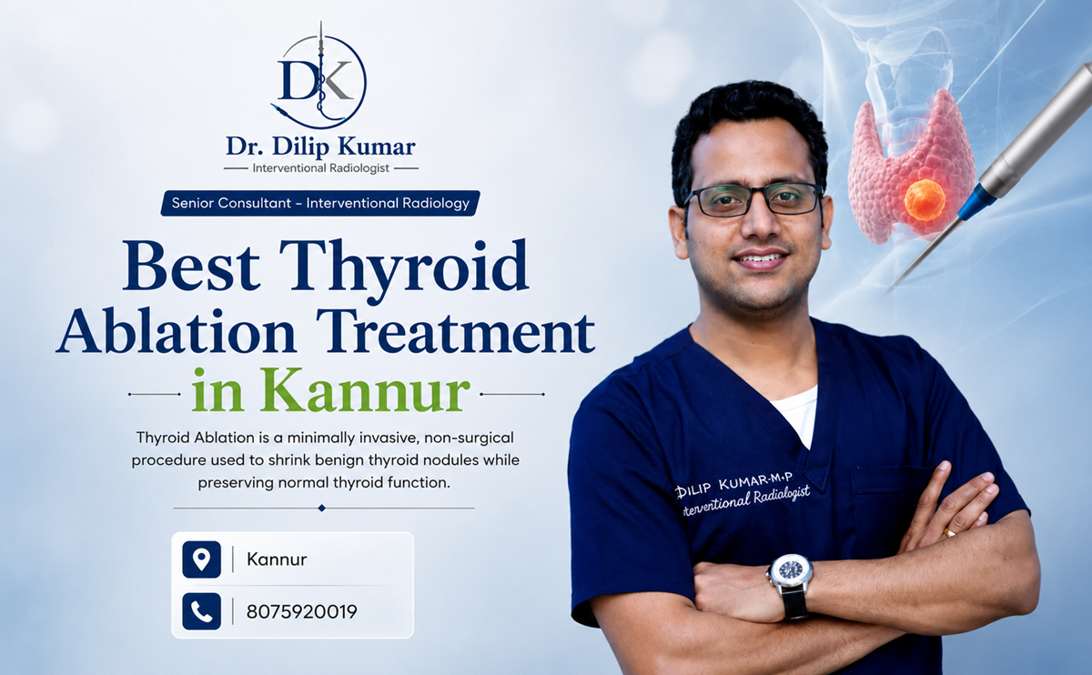 Best Thyroid Ablation Treatment