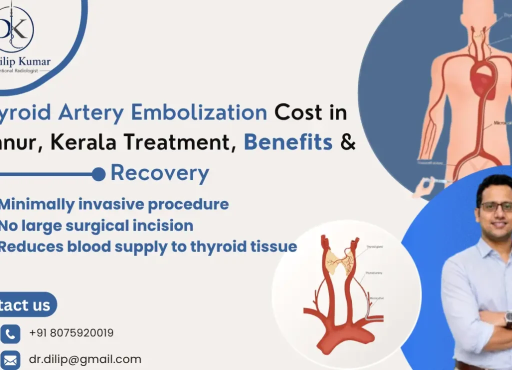 Thyroid Artery Embolization Cost in Kannur