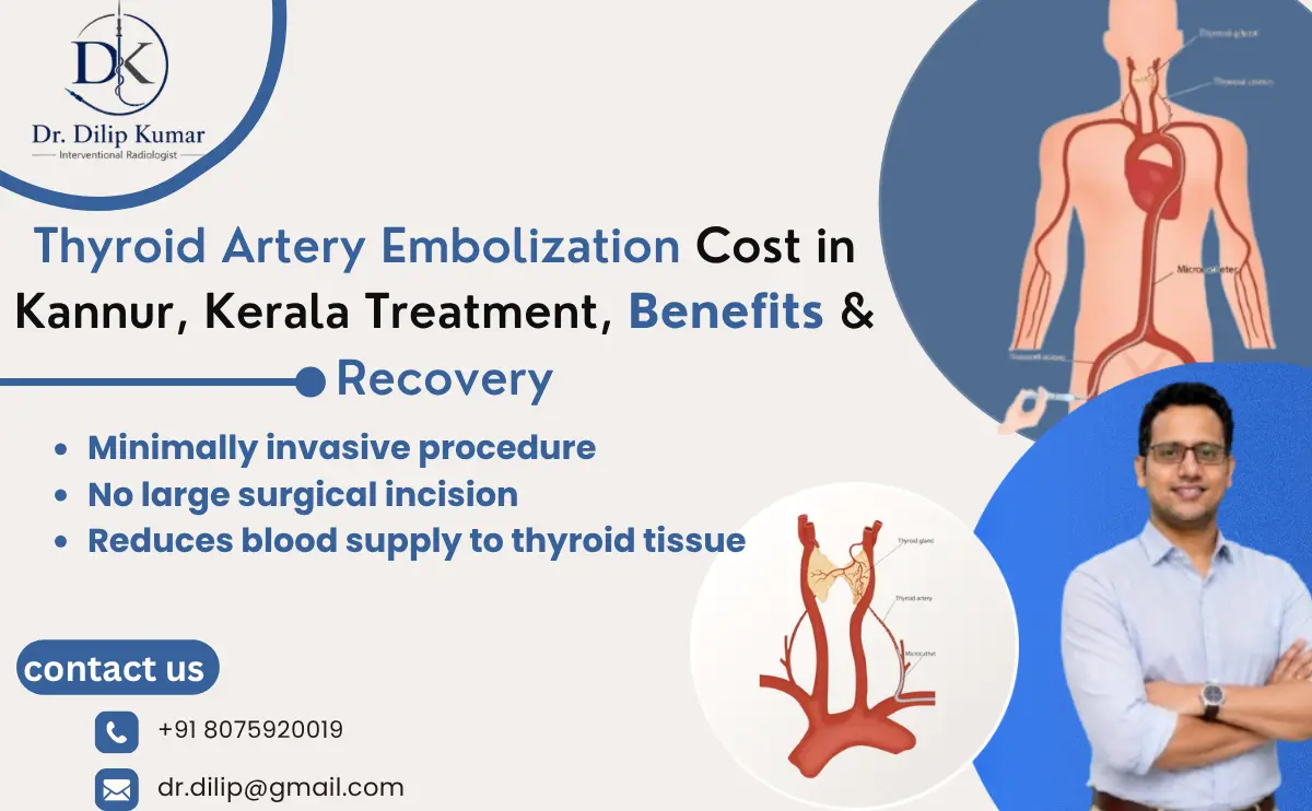 Thyroid Artery Embolization Cost in Kannur