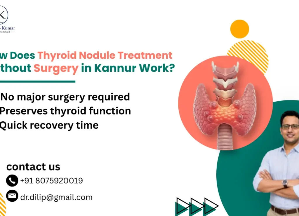 Thyroid Nodule Treatment Without Surgery in Kannur
