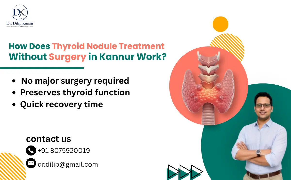 Thyroid Nodule Treatment Without Surgery in Kannur