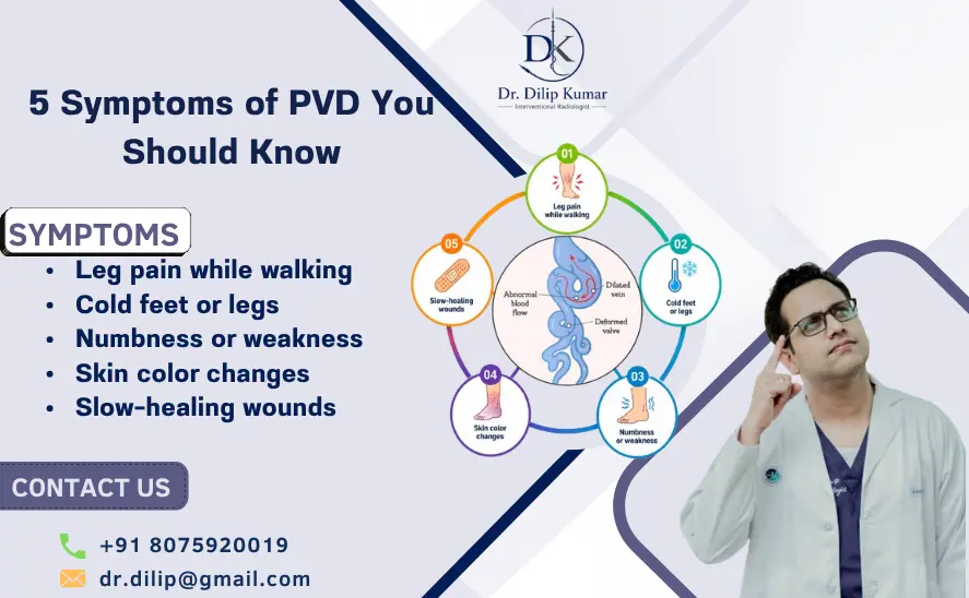 5 Symptoms of PVD You Should Know