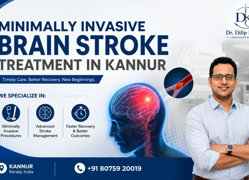 Minimally Invasive Brain Stroke Treatment in Kannur
