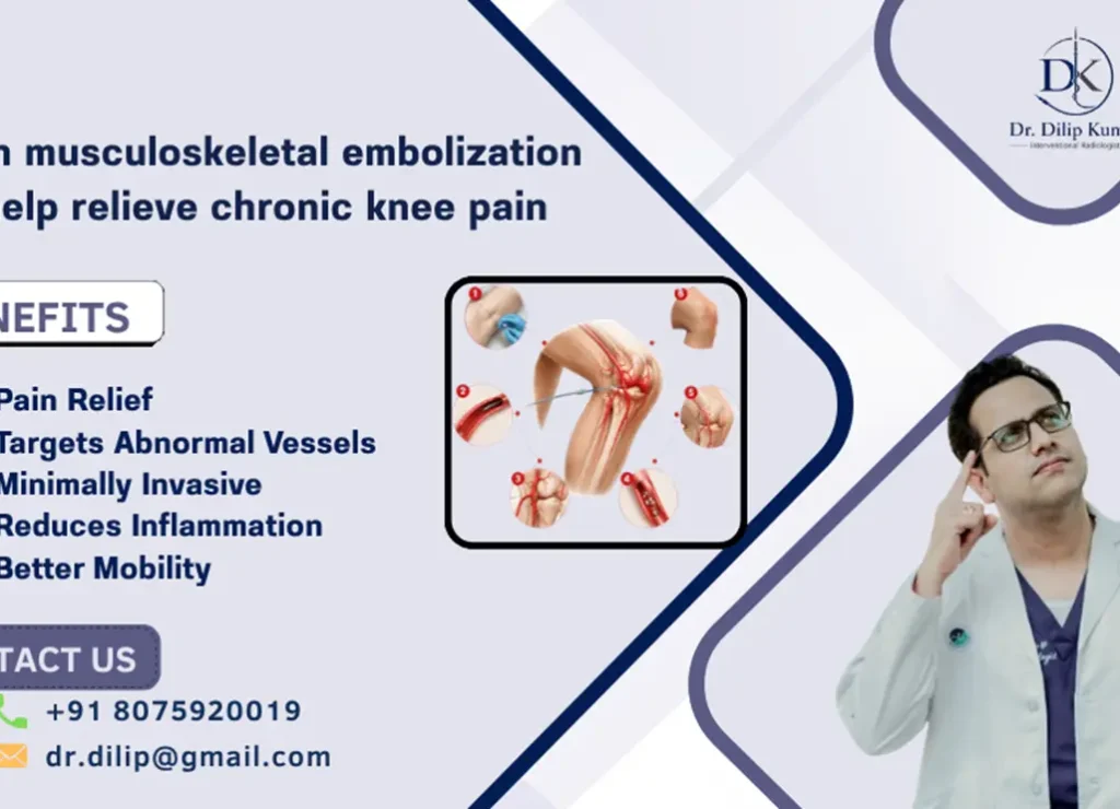 Musculoskeletal Embolization for Chronic Knee Pain