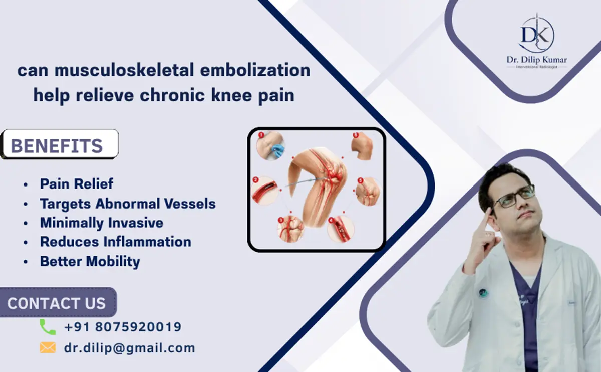 Musculoskeletal Embolization for Chronic Knee Pain
