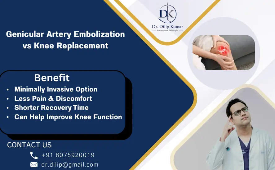 Genicular Artery Embolization vs Knee Replacement